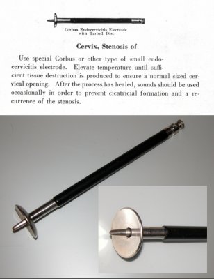 Cervix electrode